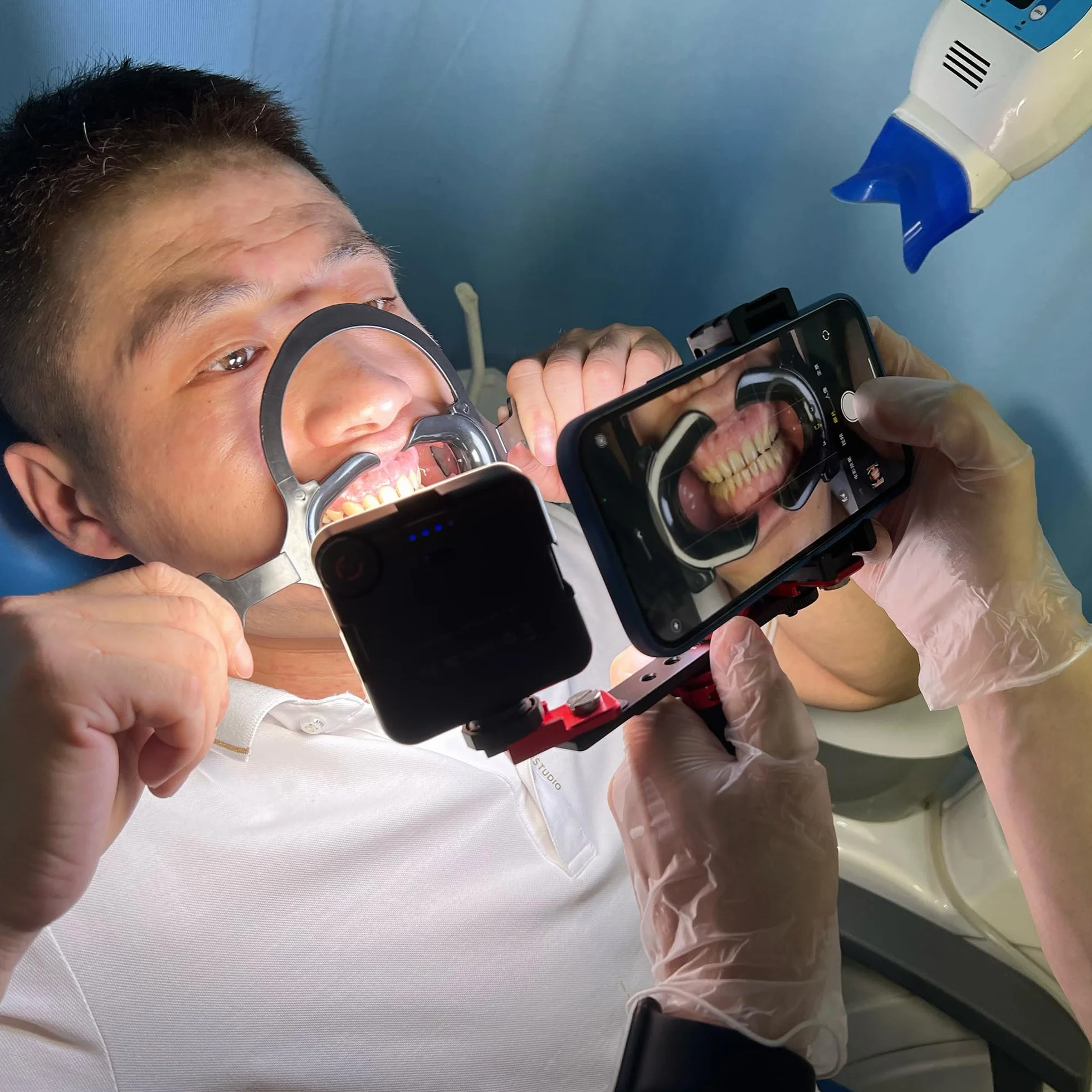 MK16 v2 lampa do fotografii stomatologicznej na telefon komórkowy - zdjęcia i filmy wewnątrzustne z telefonem dla dentysty